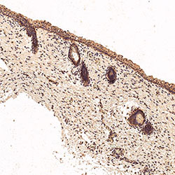 sars-cov-2 gene expression in a human fetus